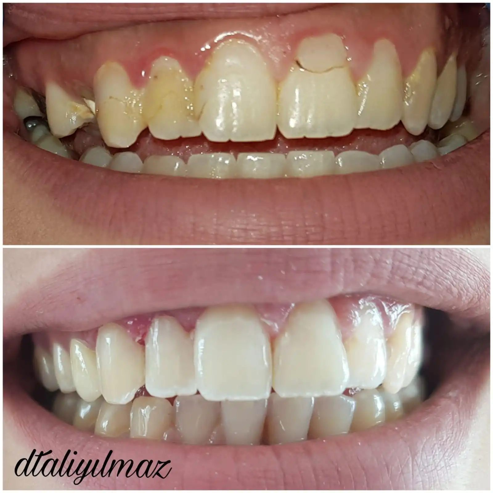 Patient Transformation 1