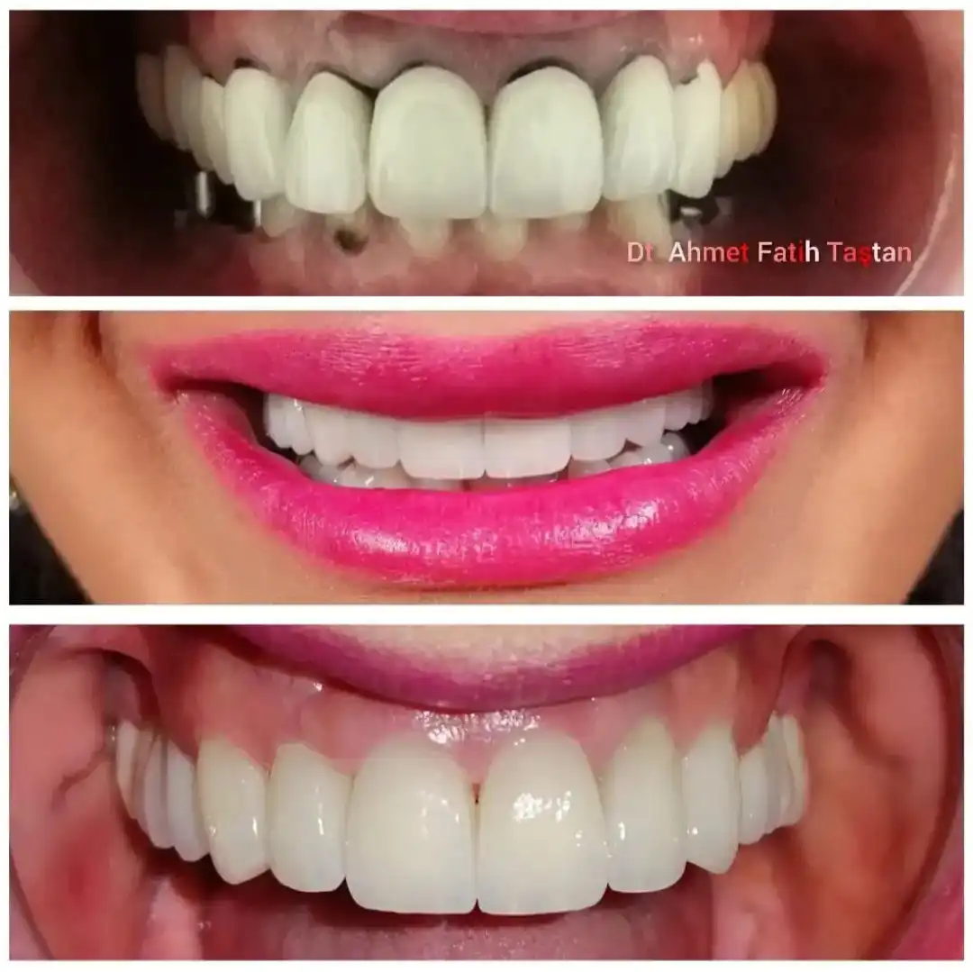 Patient Transformation 10