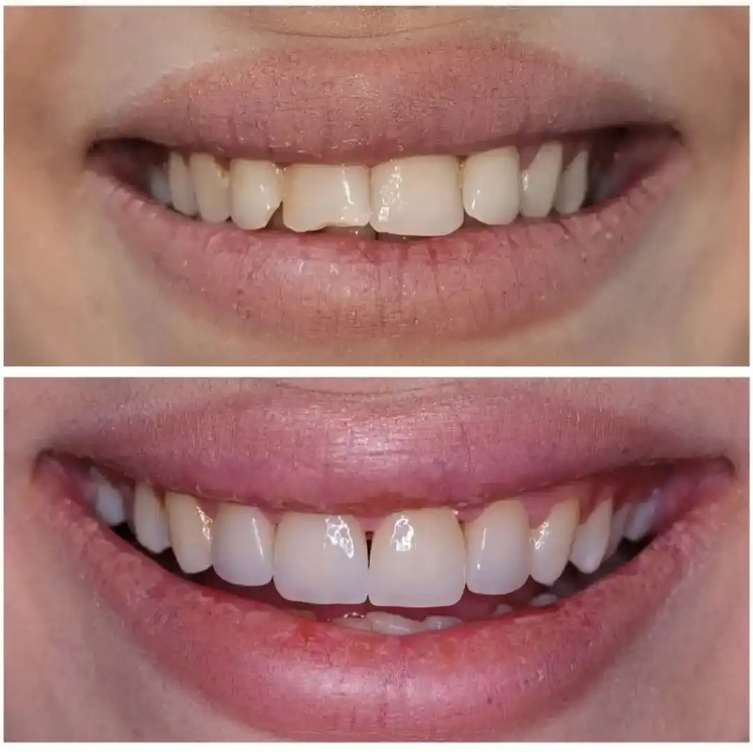 Patient Transformation 11