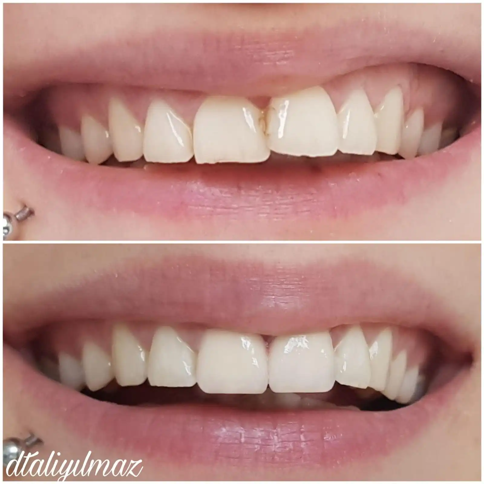 Patient Transformation 2