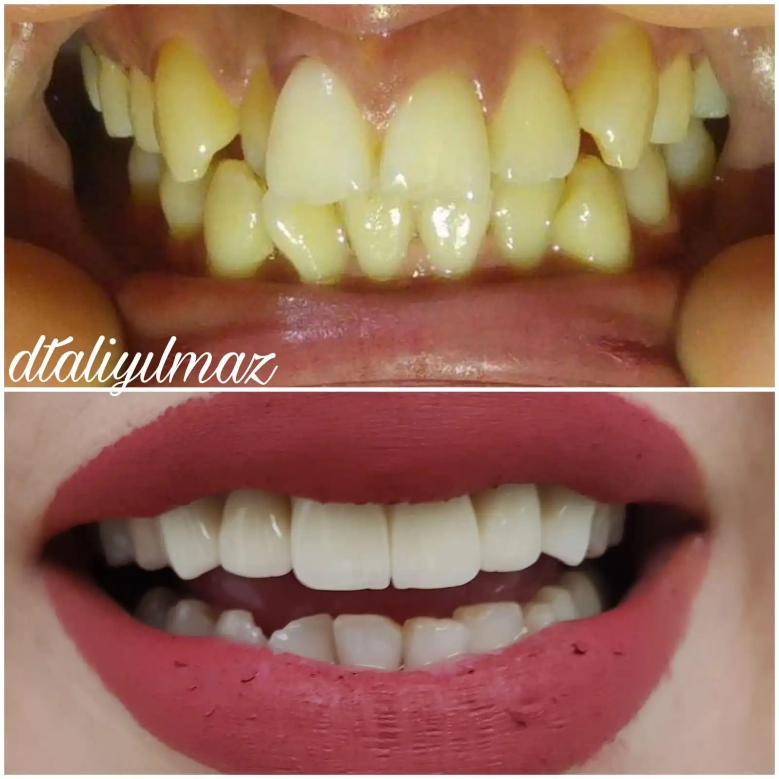 Patient Transformation 3