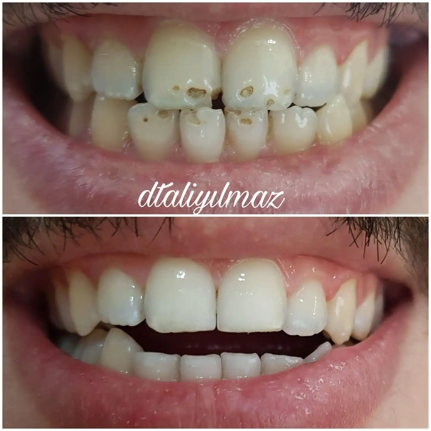 Patient Transformation 4