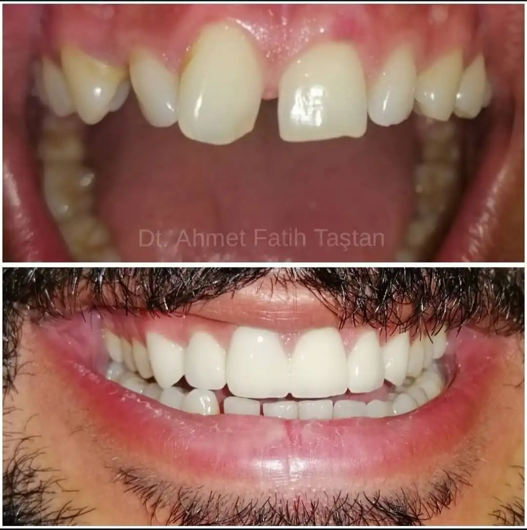 Patient Transformation 5