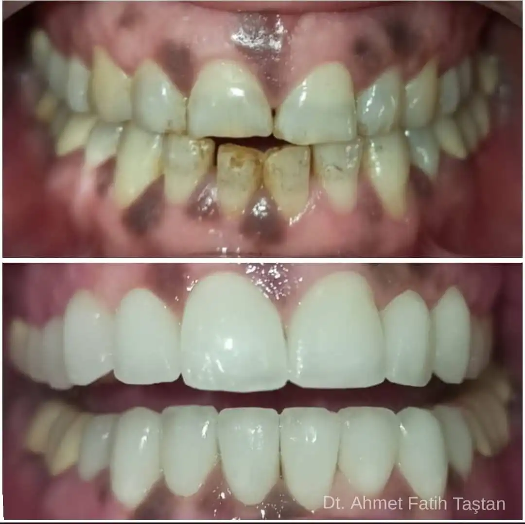 Patient Transformation 6