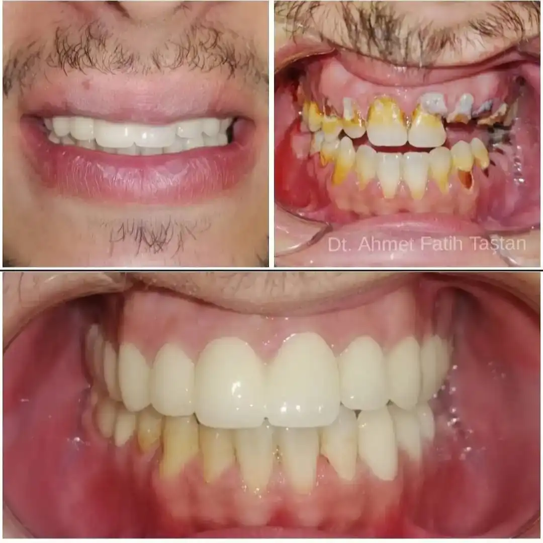 Patient Transformation 7