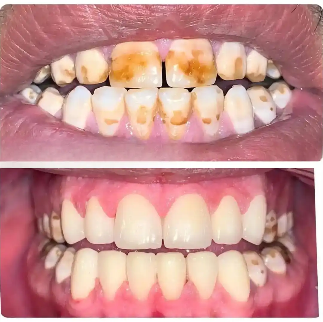 Patient Transformation 8