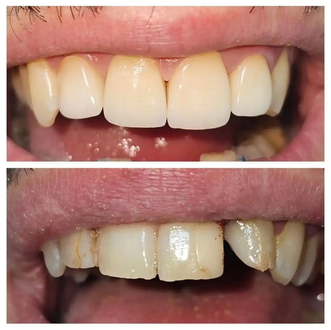 Patient Transformation 9